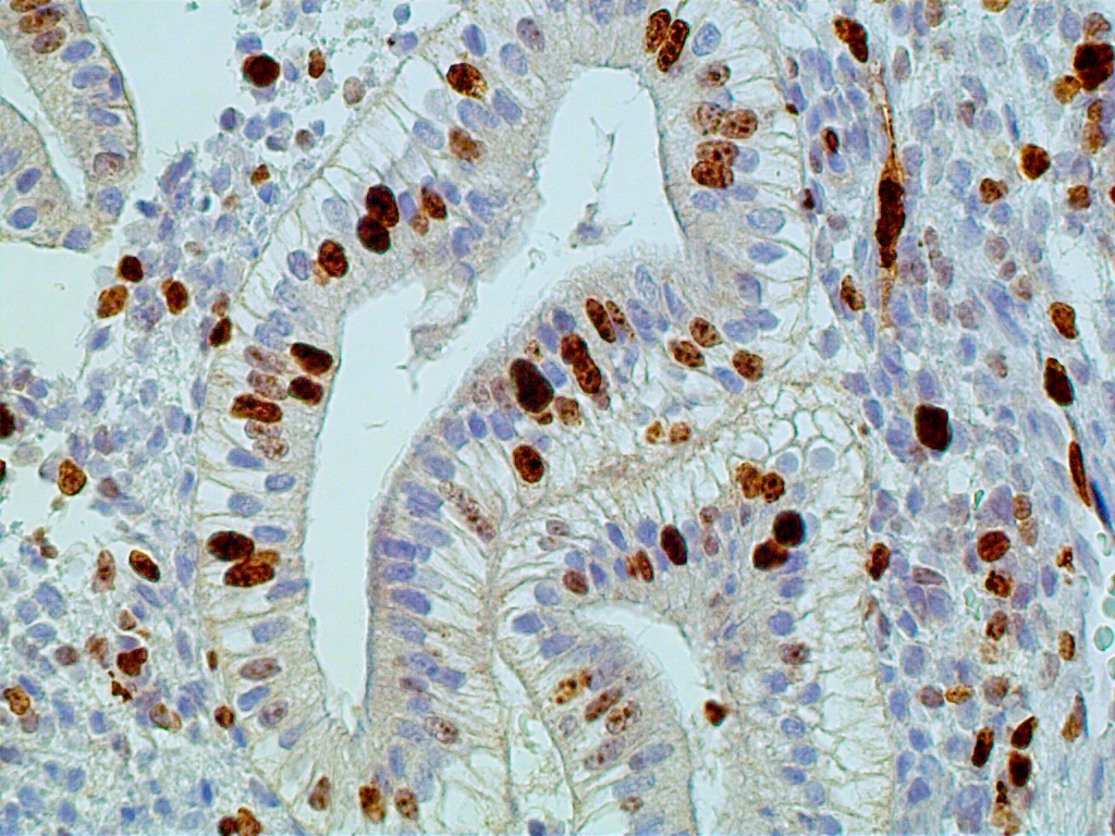 ihc positive cells